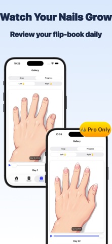 StopBite: Nail Biting Tracker Screenshot 3 of 9