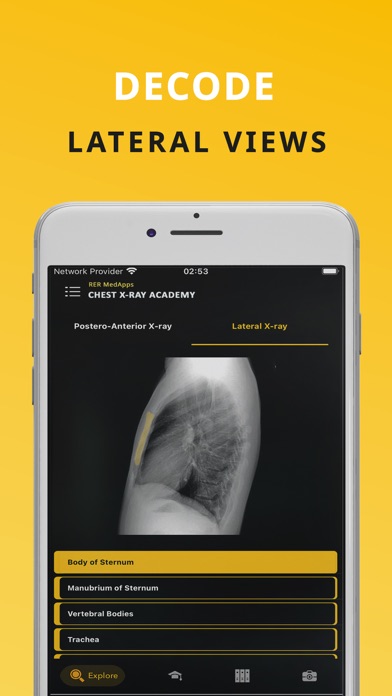 Chest X-ray (CXR) Made Easy Screenshot