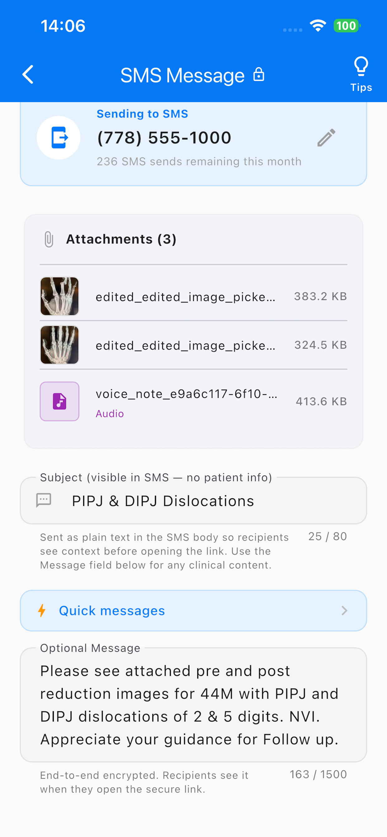 EmmsApp screenshot 6