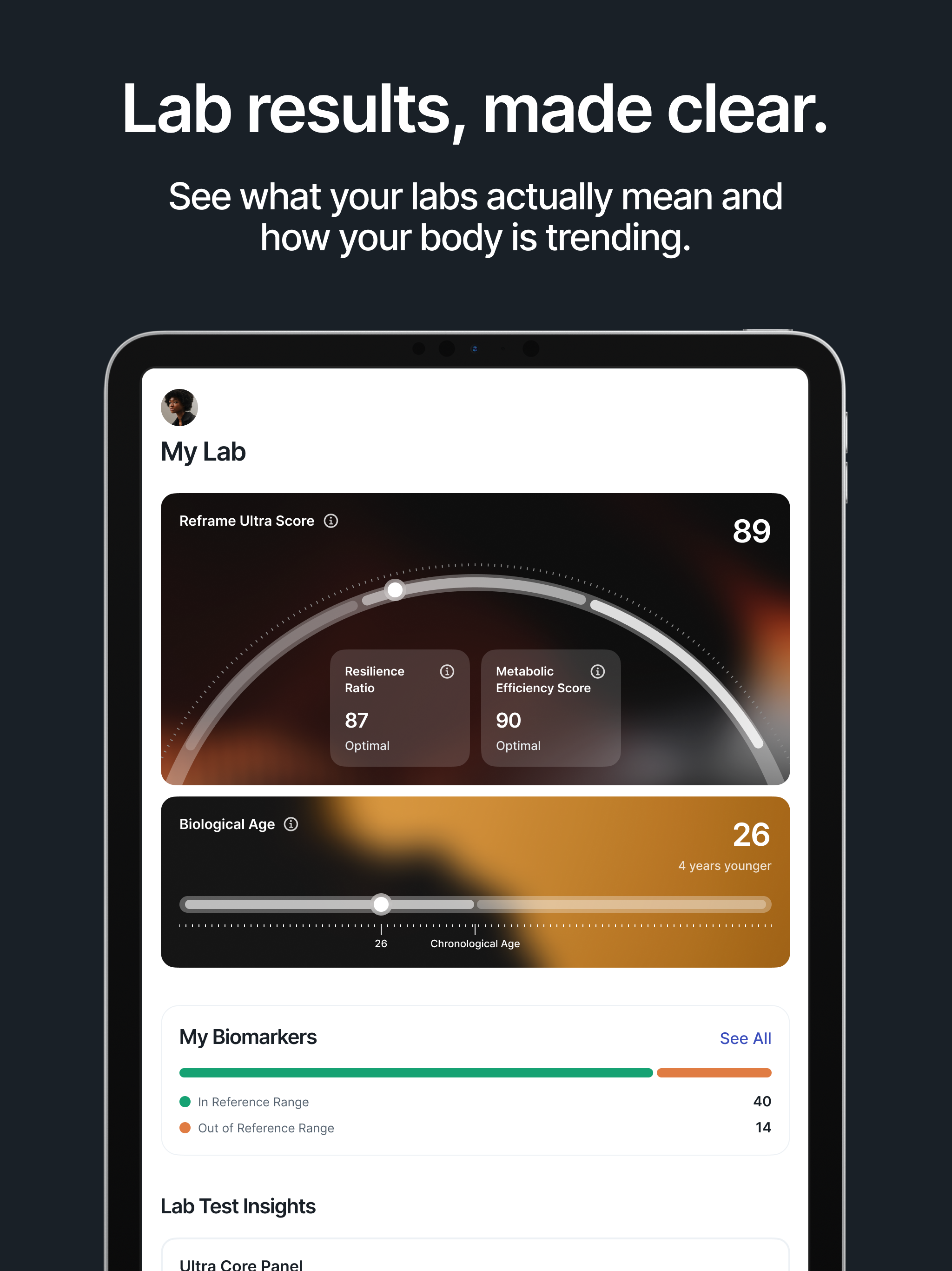 Reframe Ultra