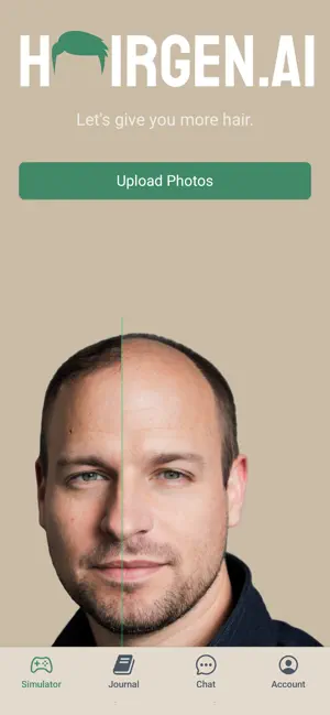 Hairgen.ai AI Hair Transplants screenshot 1