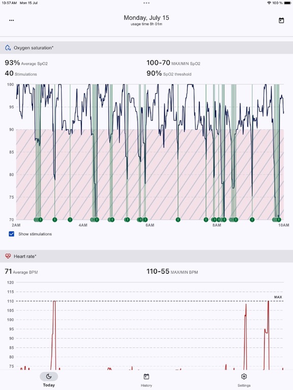 Somni iPad screenshot 1 - Medical app