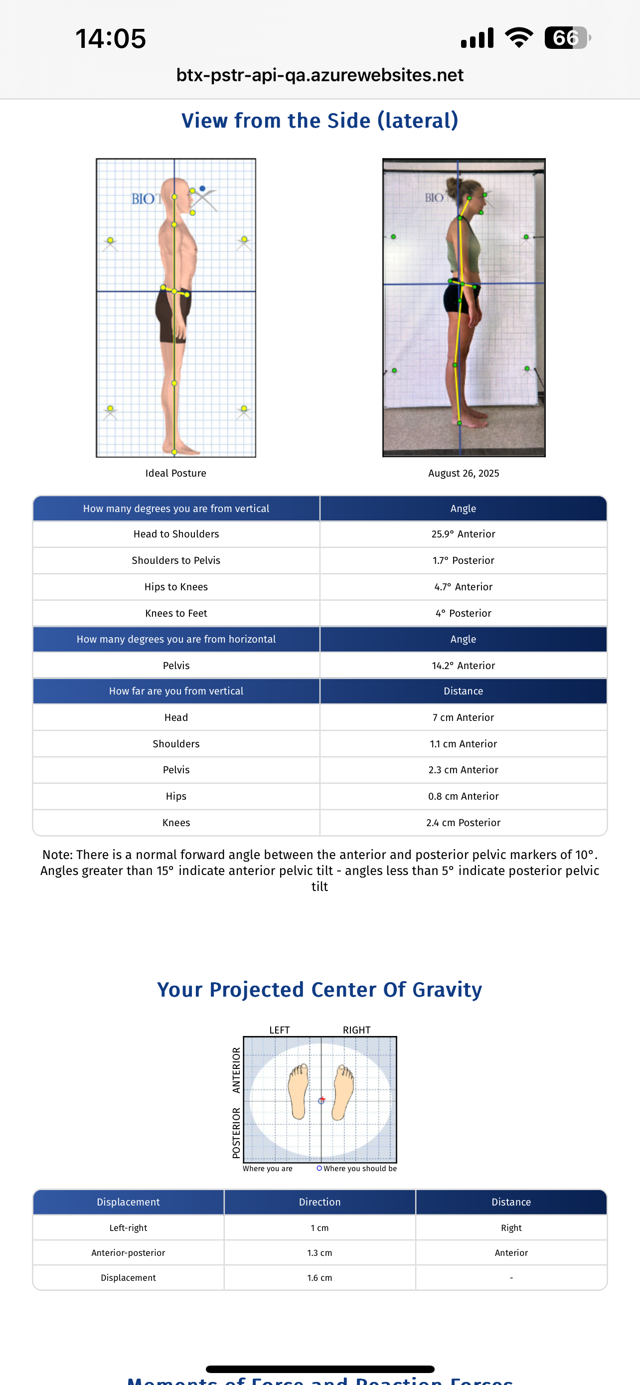 Biotonix Posture Assistant Pro screenshot 3