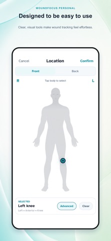 WoundFocus Personal Screenshot 4 of 4