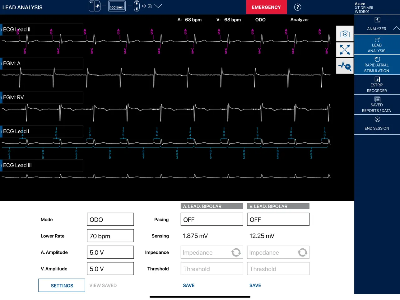 Screenshot #5 pour CareLink SmartSync™ EU