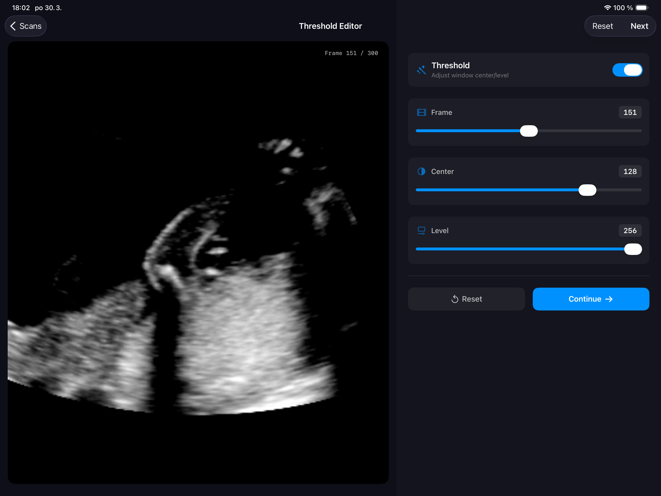 3D Baby Viewer