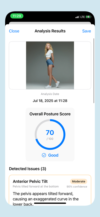 Posture Align Fix Your Posture Screenshot 4 of 6