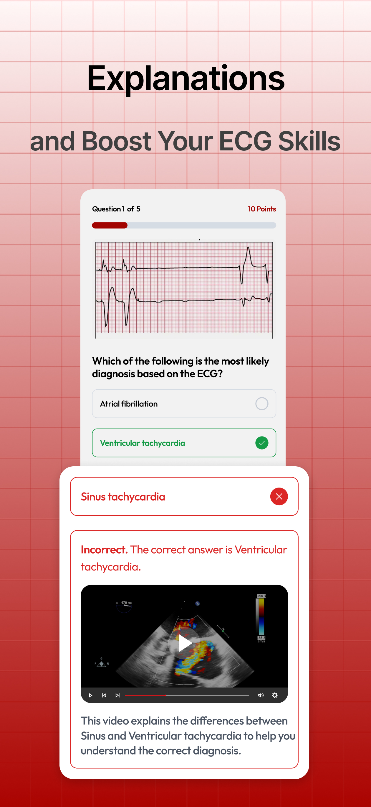 Cardiogram Cases: EKG Practice screenshot 5