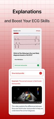 Cardiogram Cases: EKG Practice Screenshot 5 of 6