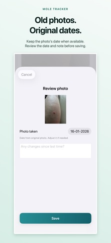 Mole Tracker: Skin Check Diary Screenshot 4 of 10