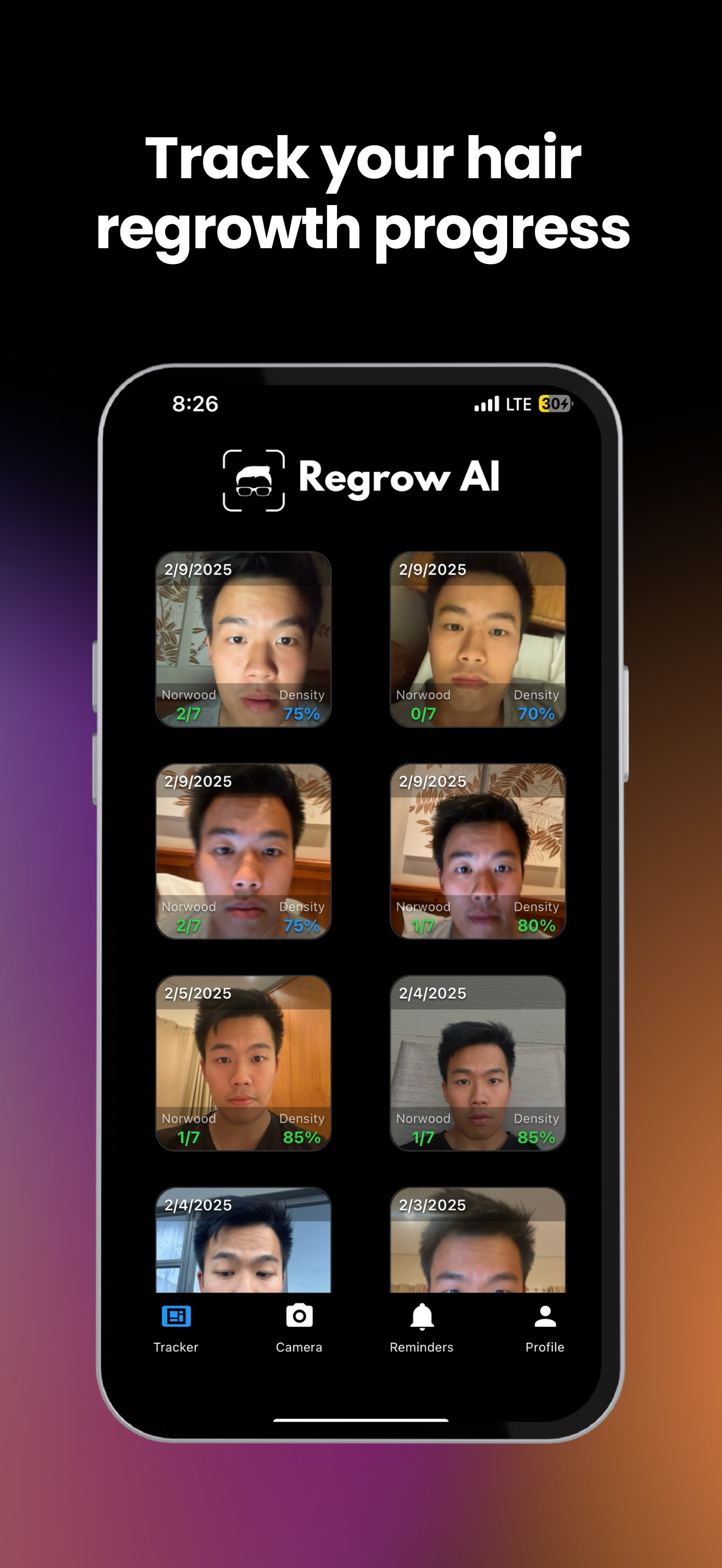 Regrow AI: Scan Hair Loss