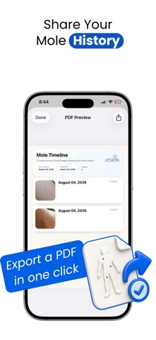 Jeskin Mole Tracker Screenshot 5 of 5