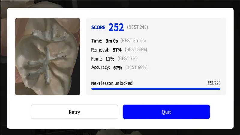 Dental MirrorMaster 3.1 screenshot 4 of 7