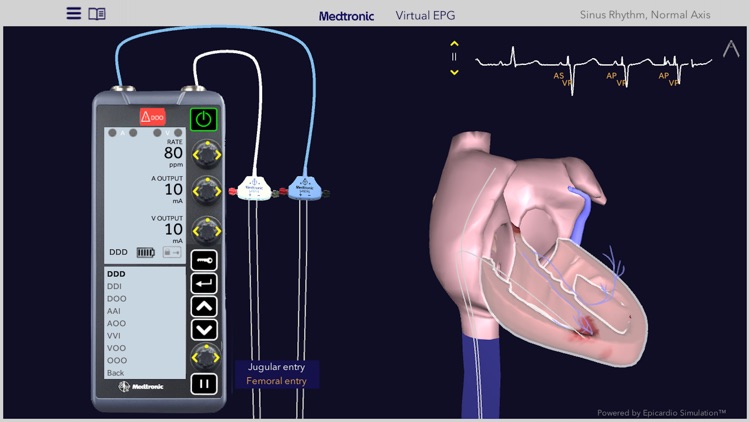 Medtronic VirtualEPG screenshot-3