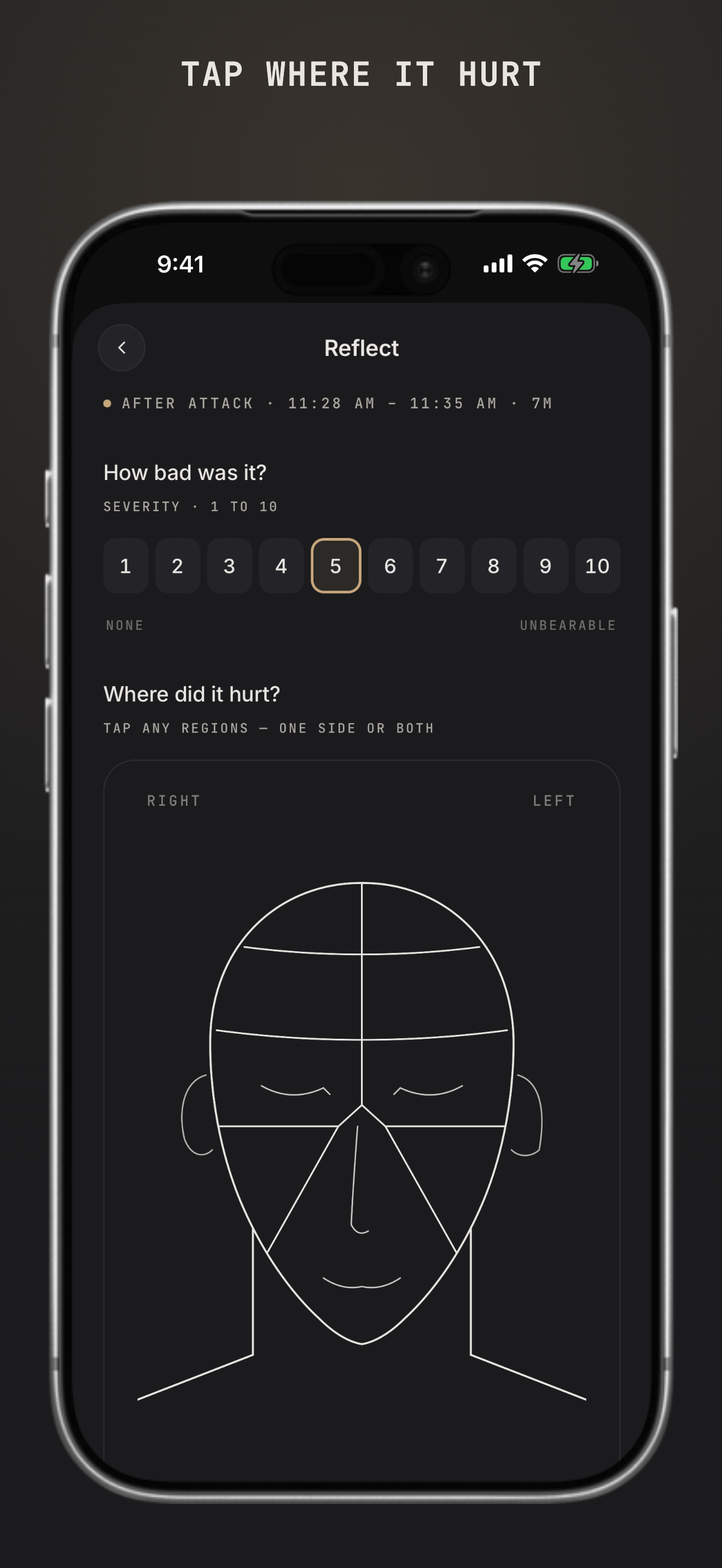 Mign: Migraine Tracker