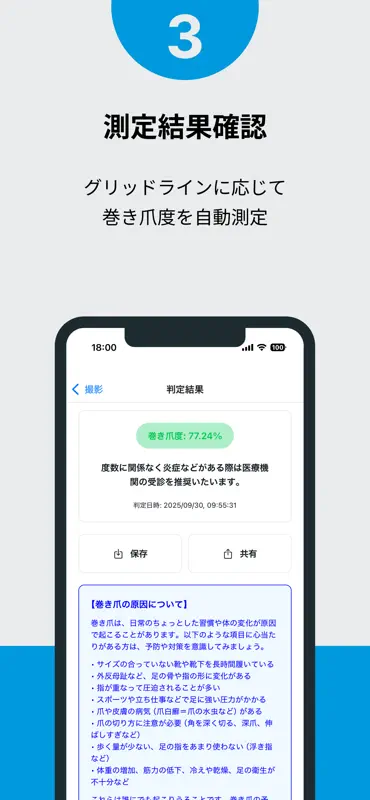 巻き爪チェッカー screenshot 4 of 4