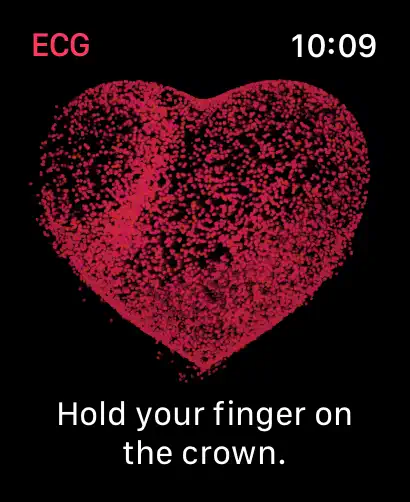 #1. ECG (iOS) By: Apple