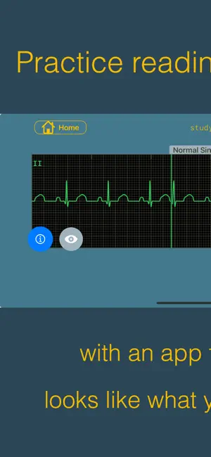 arrhythmia screenshot 1