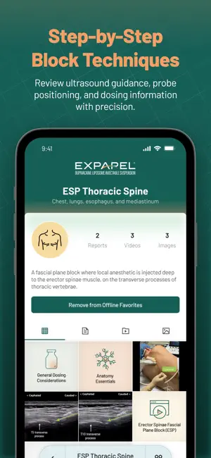 EXPAREL® NOW screenshot 2