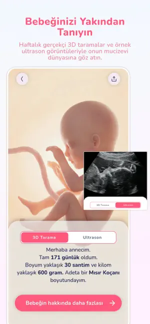 MommyBump screenshot 2