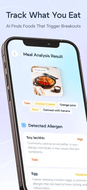 Lumé: Skin Scanner screenshot 3