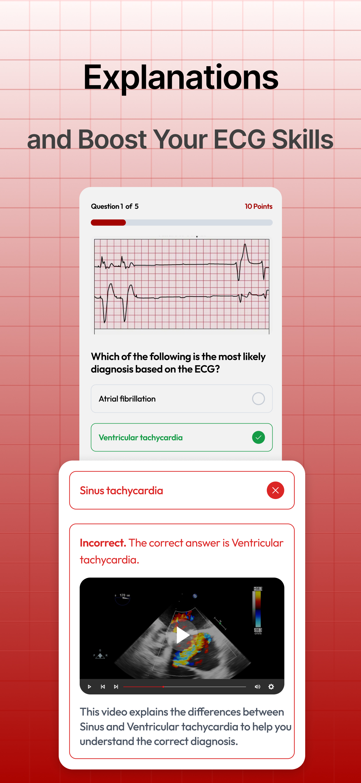 Cardiology Cases: EKG Practice