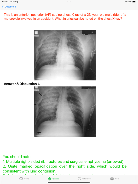 Screenshot #5 pour X-Ray Interpretation Guide