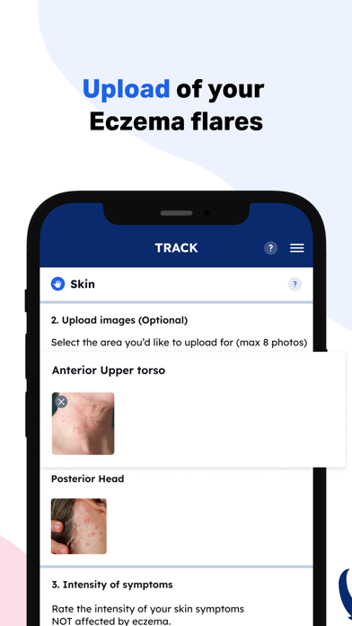 Eczema Skin Care | EczemaWise Screenshot