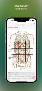 Stedman's Medical Dictionary N screenshot #3 for iPhone