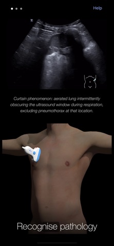 PoCUS Pocket Trainer Screenshot 3 of 5