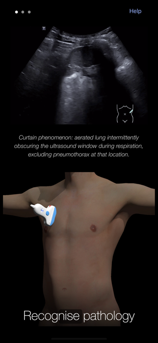PoCUS Pocket Trainer Screenshot 3 of 5