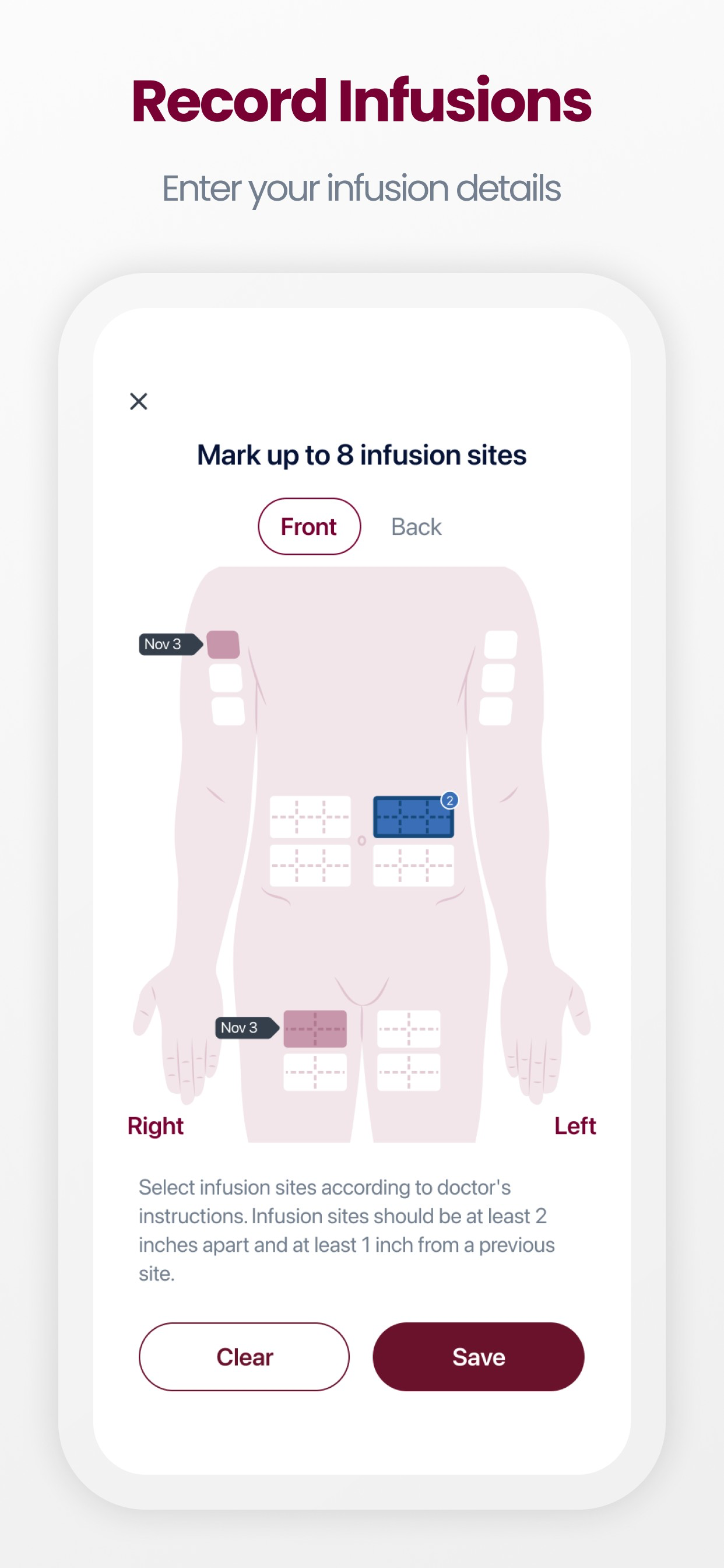 Hizentra App