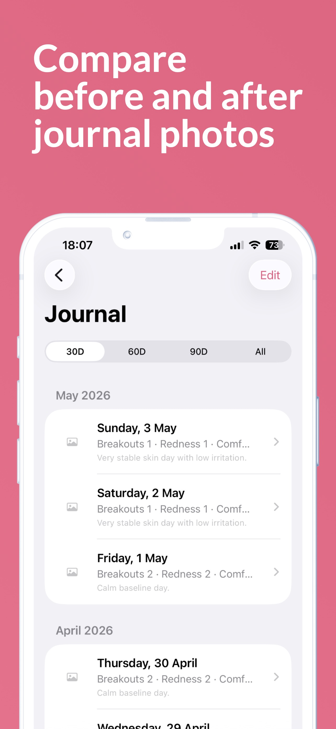 SkinLattice: Skincare Tracker