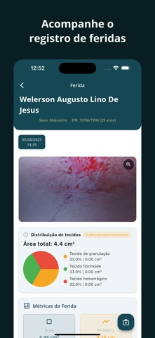 WoundCare: Cuidado de Feridas screenshot