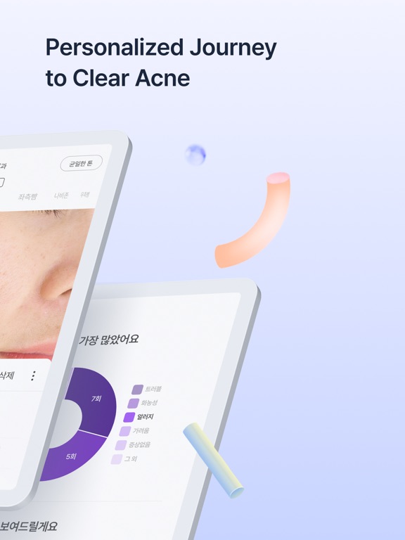 Skinlog | Acne diary iPad screenshot 2 - Lifestyle app