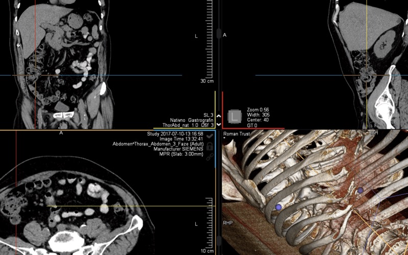 DICOM Viewer Pro Screenshot