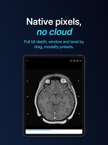 Lumen — DICOM viewer iPad screenshot