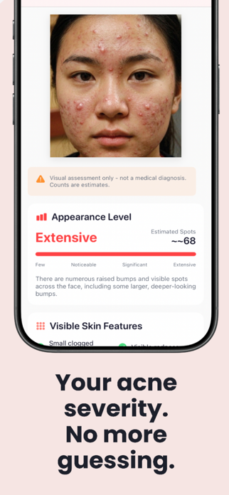 Acnera - Acne & Skin Tracker Screenshot 2 of 7