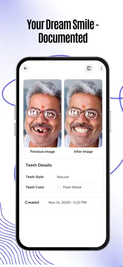 Captura de pantalla de Teethsi | AI Veneer Try On en iPhone 4