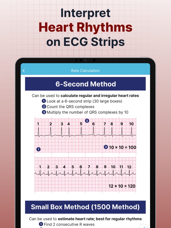 ECG EKG Interpretation Mastery iPad screenshot 4 - Medical app