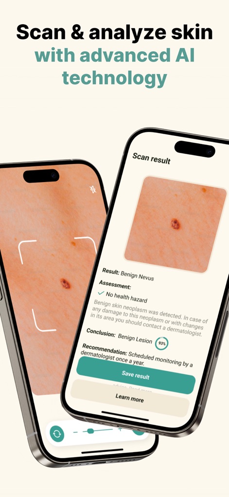 Skin scanner, dermatology&acne - Medical App | MWM