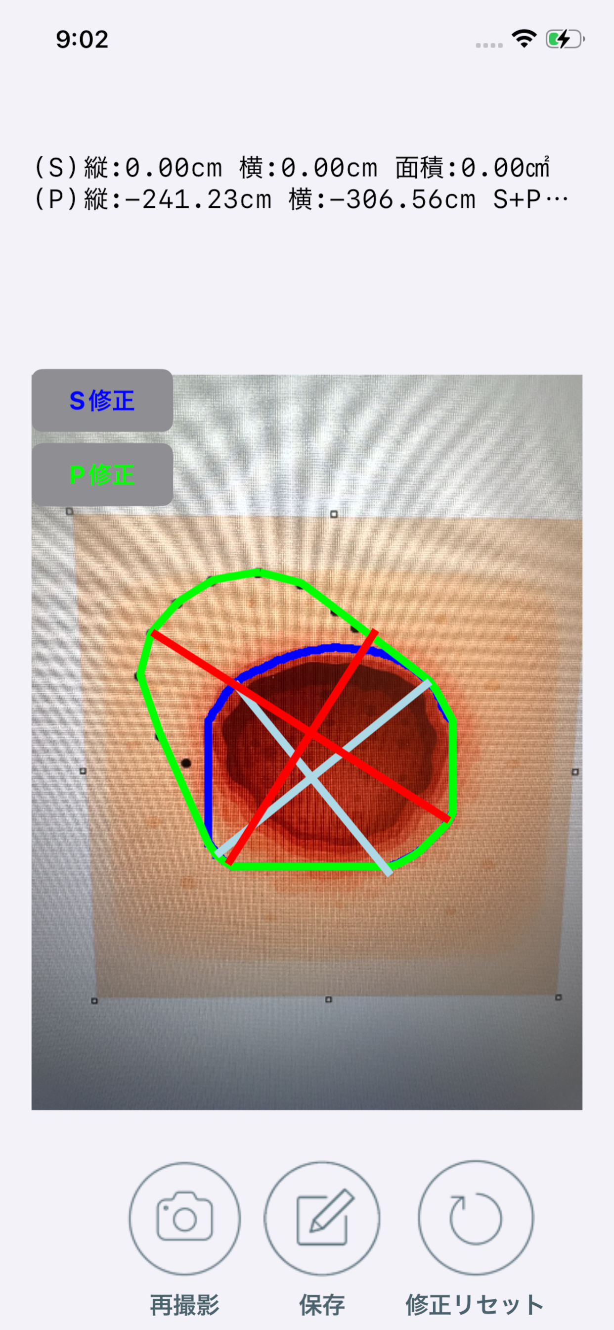 褥瘡Measure screenshot 5