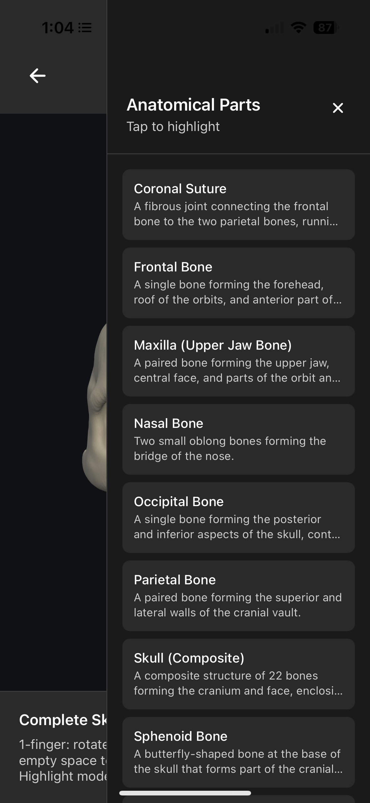 Anterior3D