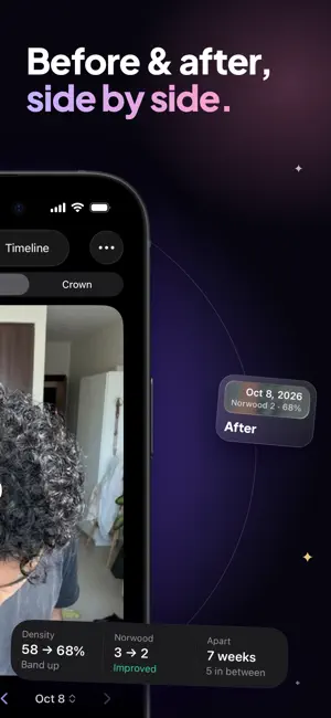 Keep Hair: Hair Loss Tracker screenshot 2