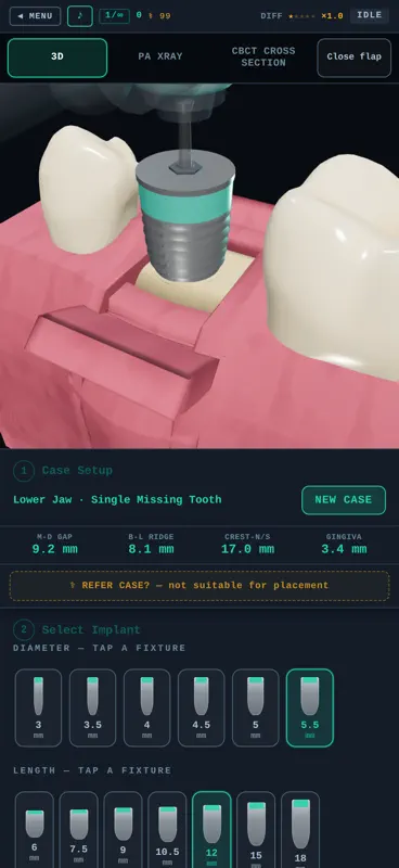 OsseoSim: Implant Trainer screenshot 3 of 5