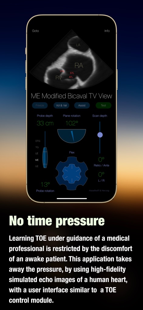 TEE Simulator - App de Educación | MWM