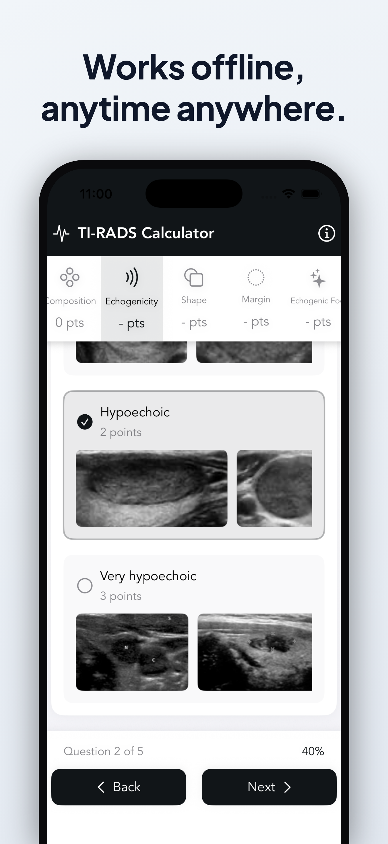 Easy TI-RADS Calculator screenshot 4