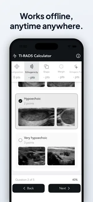 Easy TI-RADS Calculator screenshot 4