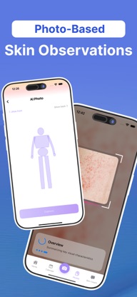 SkinAI Scan - Mole Tracker screenshot 2