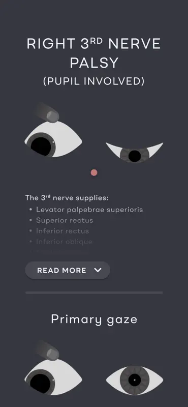 Eyemo screenshot 2 of 10